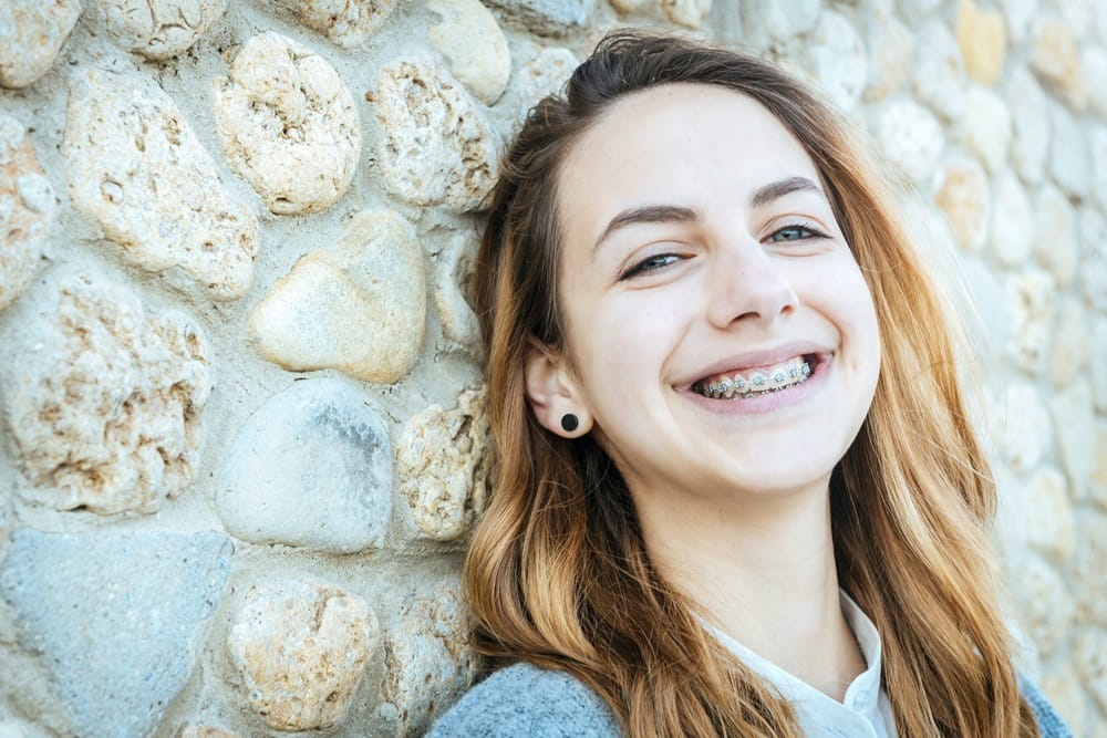 Smiling Young Woman with Braces Outdoors - Services A young woman with long light brown hair smiles brightly, showing her braces. She is standing against a stone wall, wearing a casual outfit, and her cheerful expression highlights a natural, carefree moment. - Services