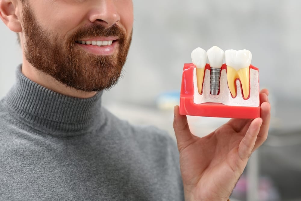 Man holding a dental model - Dental Crowns A smiling man holds a dental model showing a dental implant with a crown on top, positioned between two natural teeth. - Dental Crowns